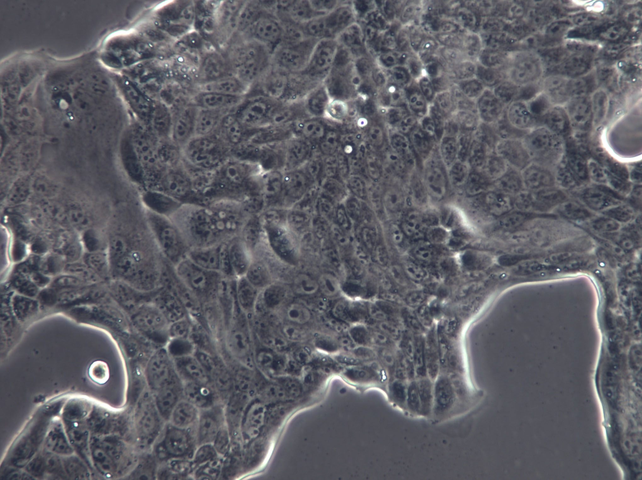 M109 Cells(赠送Str鉴定报告)|小鼠肺癌细胞,M109 Cells