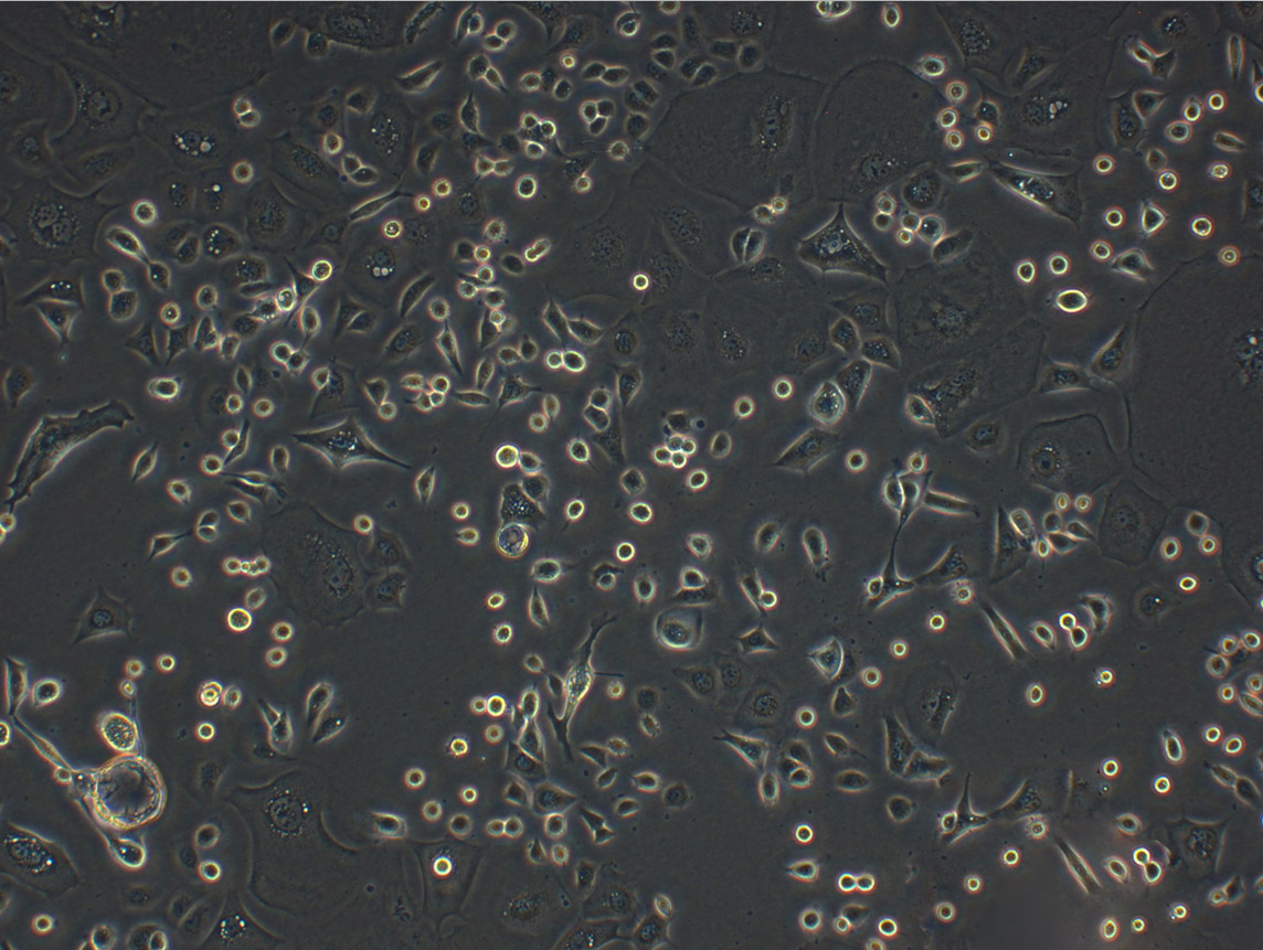 T241 Cells(赠送Str鉴定报告)|小鼠纤维肉瘤细胞,T241 Cells