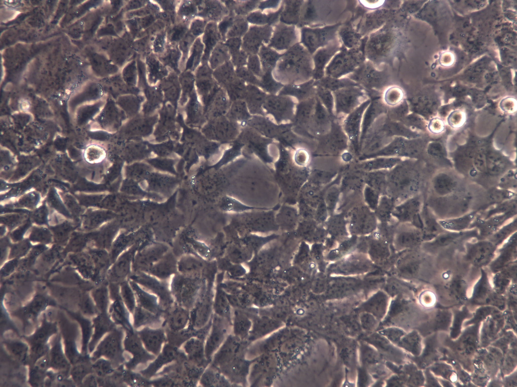 SNU-251 Cells(赠送Str鉴定报告)|人卵巢内膜癌细胞,SNU-251 Cells