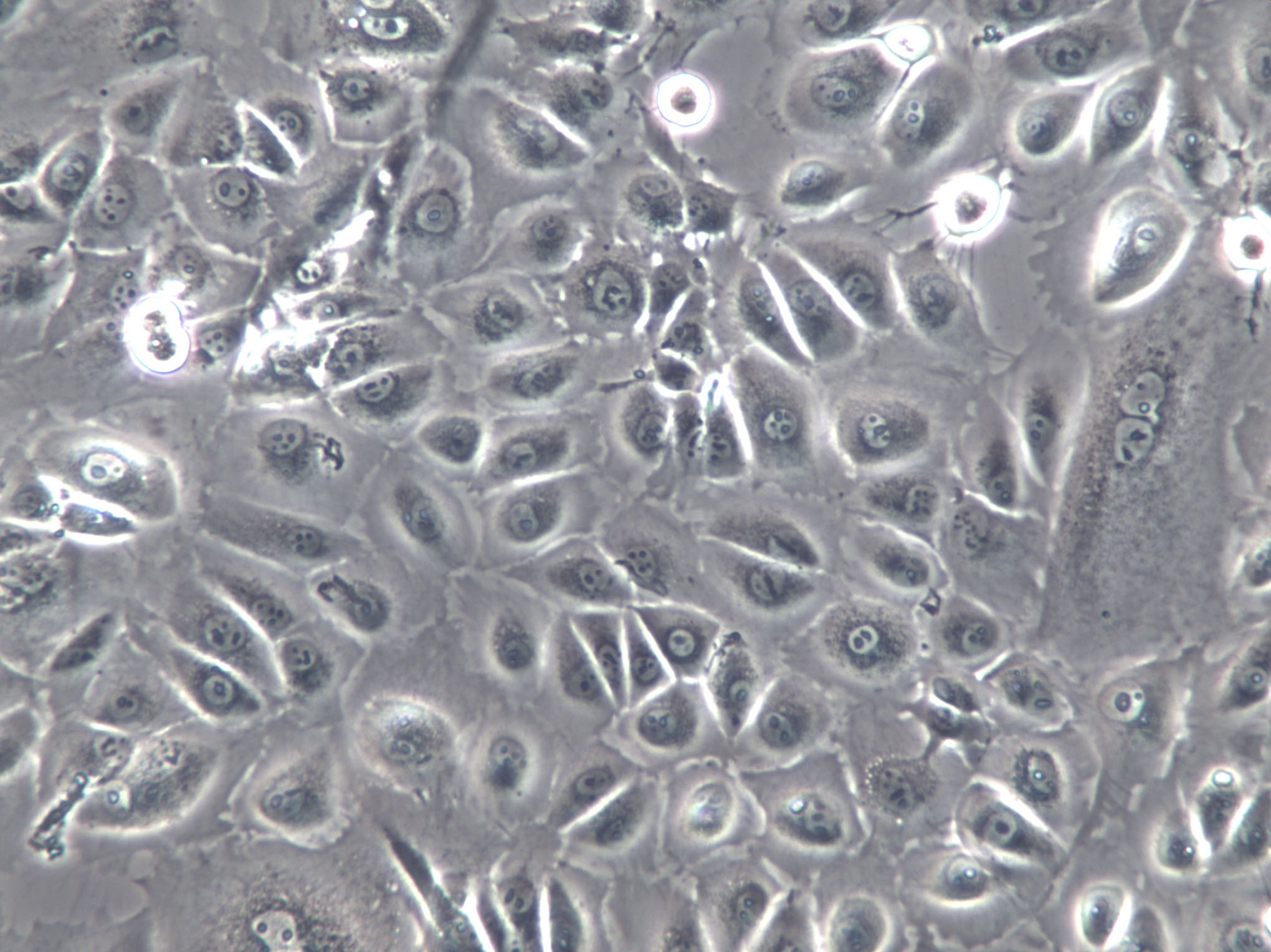 J774 Cells(赠送Str鉴定报告)|小鼠巨噬细胞,J774 Cells