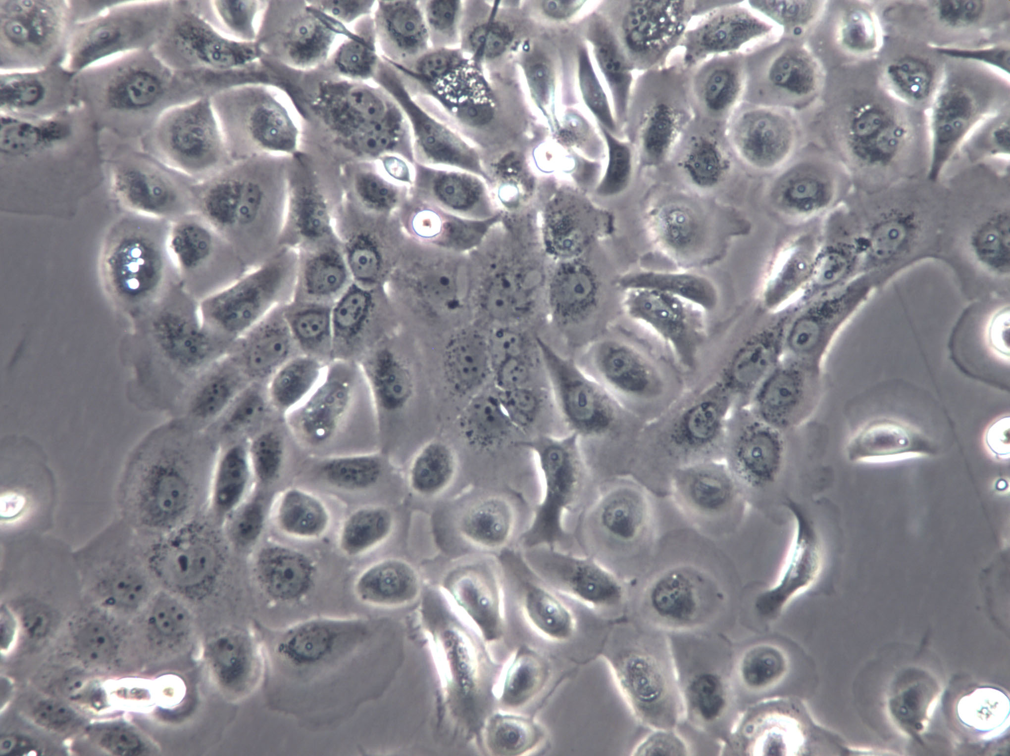 PaTu 8988s Cells|人胰腺癌克隆細(xì)胞,KGN CellsPaTu 8988s Cells