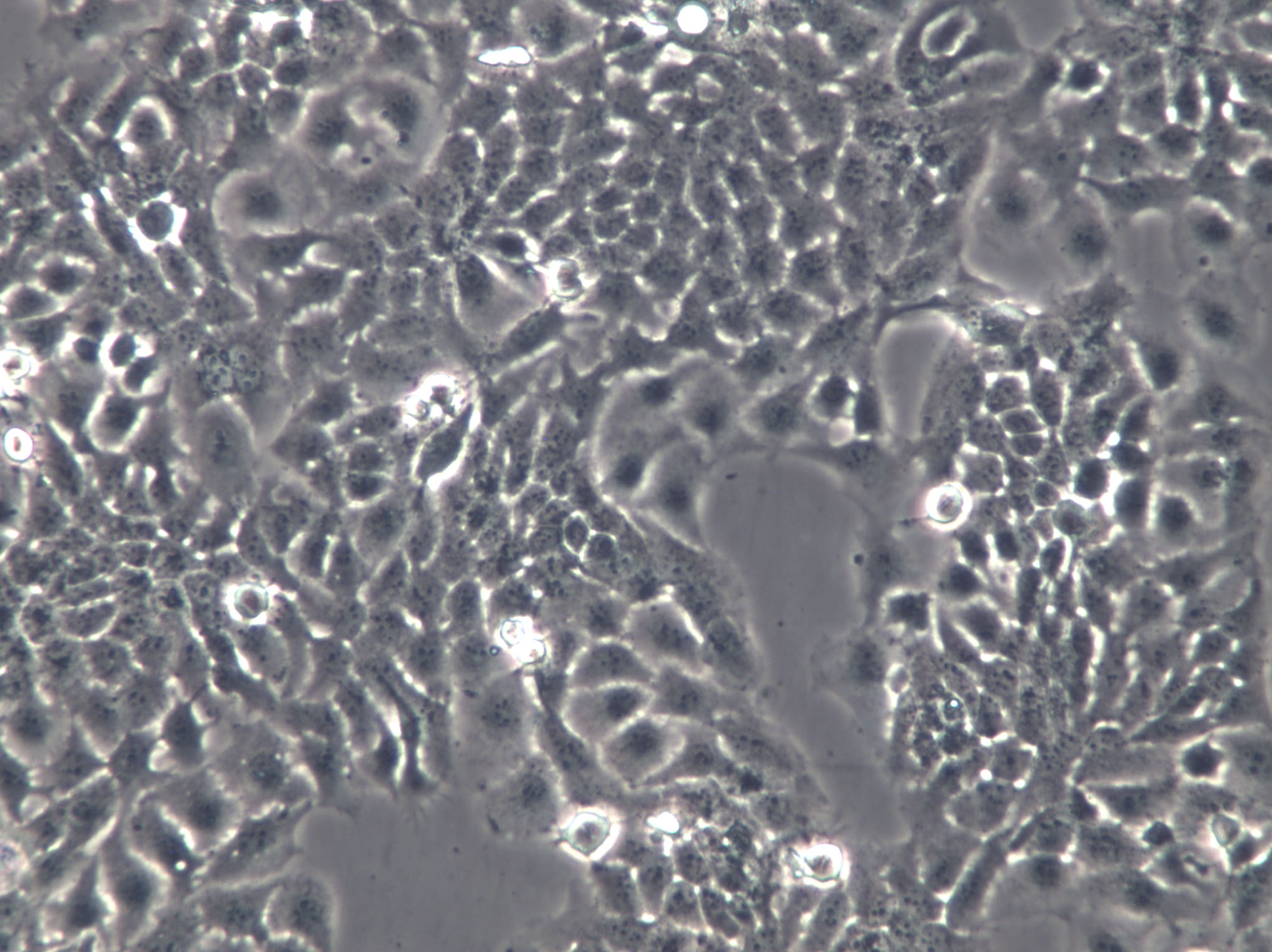 SCL-II Cells|人皮肤鳞癌克隆细胞,SCL-II Cells