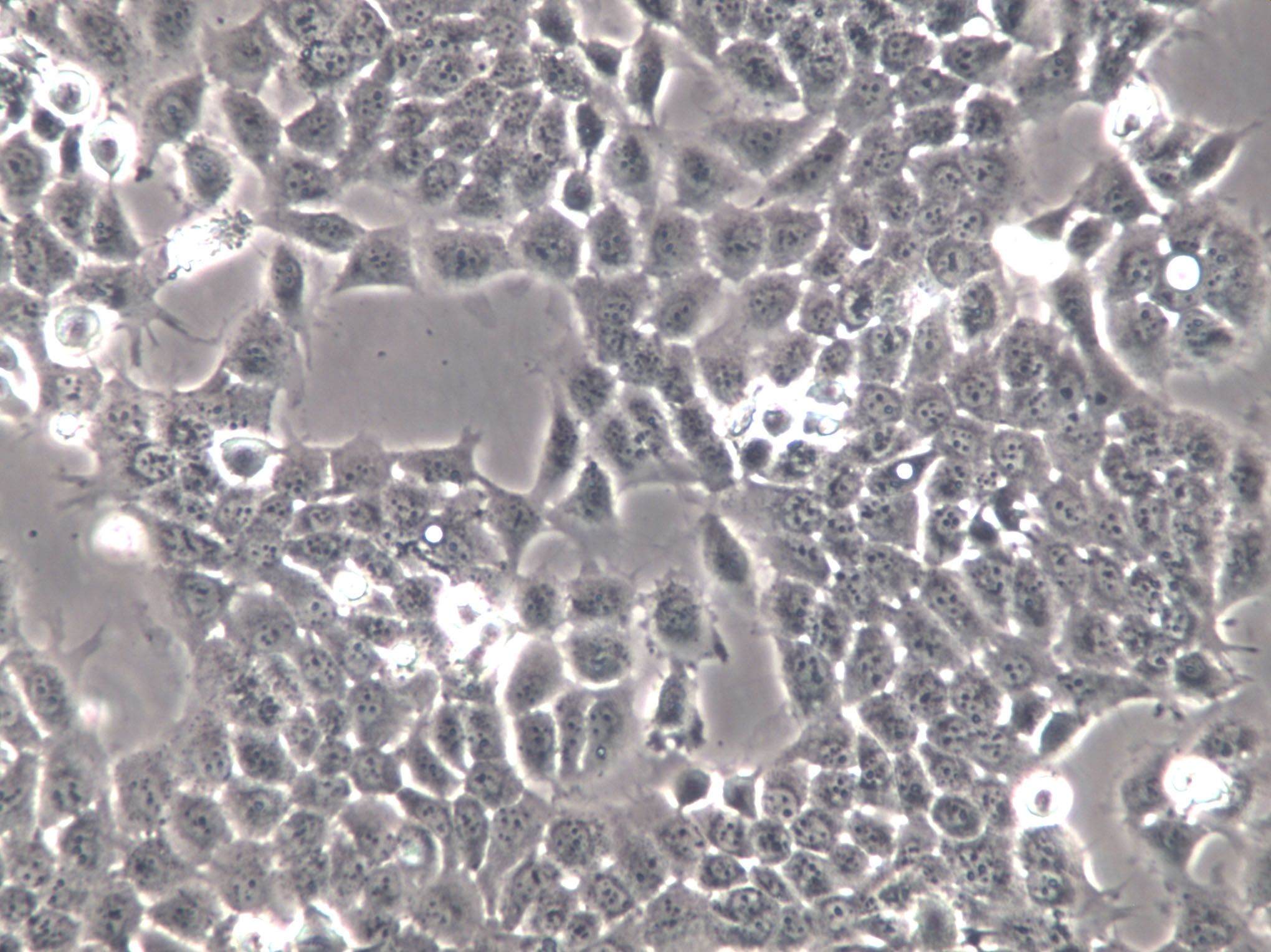 OVSAHO Cells(赠送Str鉴定报告)|人卵巢癌细胞,OVSAHO Cells