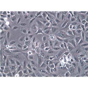 S91 Cells(赠送Str鉴定报告)|小鼠黑色素瘤细胞,S91 Cells