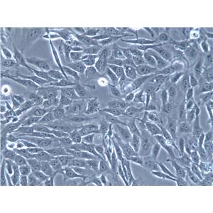LK2 Cells(赠送Str鉴定报告)|人肺鳞癌细胞