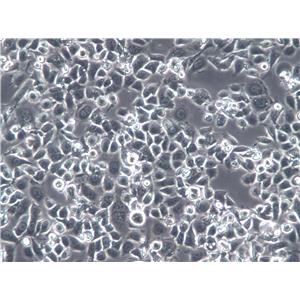 A-427 Cells(赠送Str鉴定报告)|人肺腺癌细胞