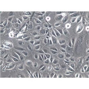 J774 Cells(赠送Str鉴定报告)|小鼠巨噬细胞