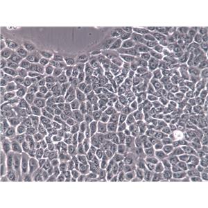 FHC Cells|人正常结直肠粘膜克隆细胞,FHC Cells