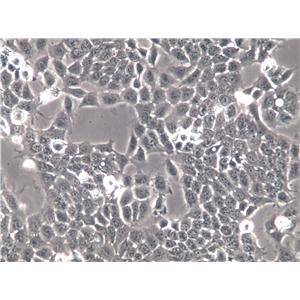 UMC-11 Cells(赠送Str鉴定报告)|人肺良性肿瘤细胞