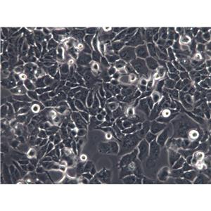 Hca-F Cells(赠送Str鉴定报告)|小鼠肝癌细胞