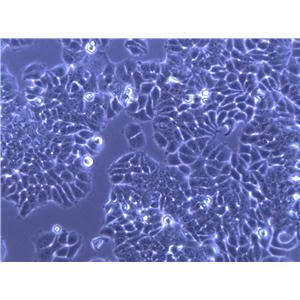 Ect1/E6E7 Cells(赠送Str鉴定报告)|人宫颈永生化鳞状细胞