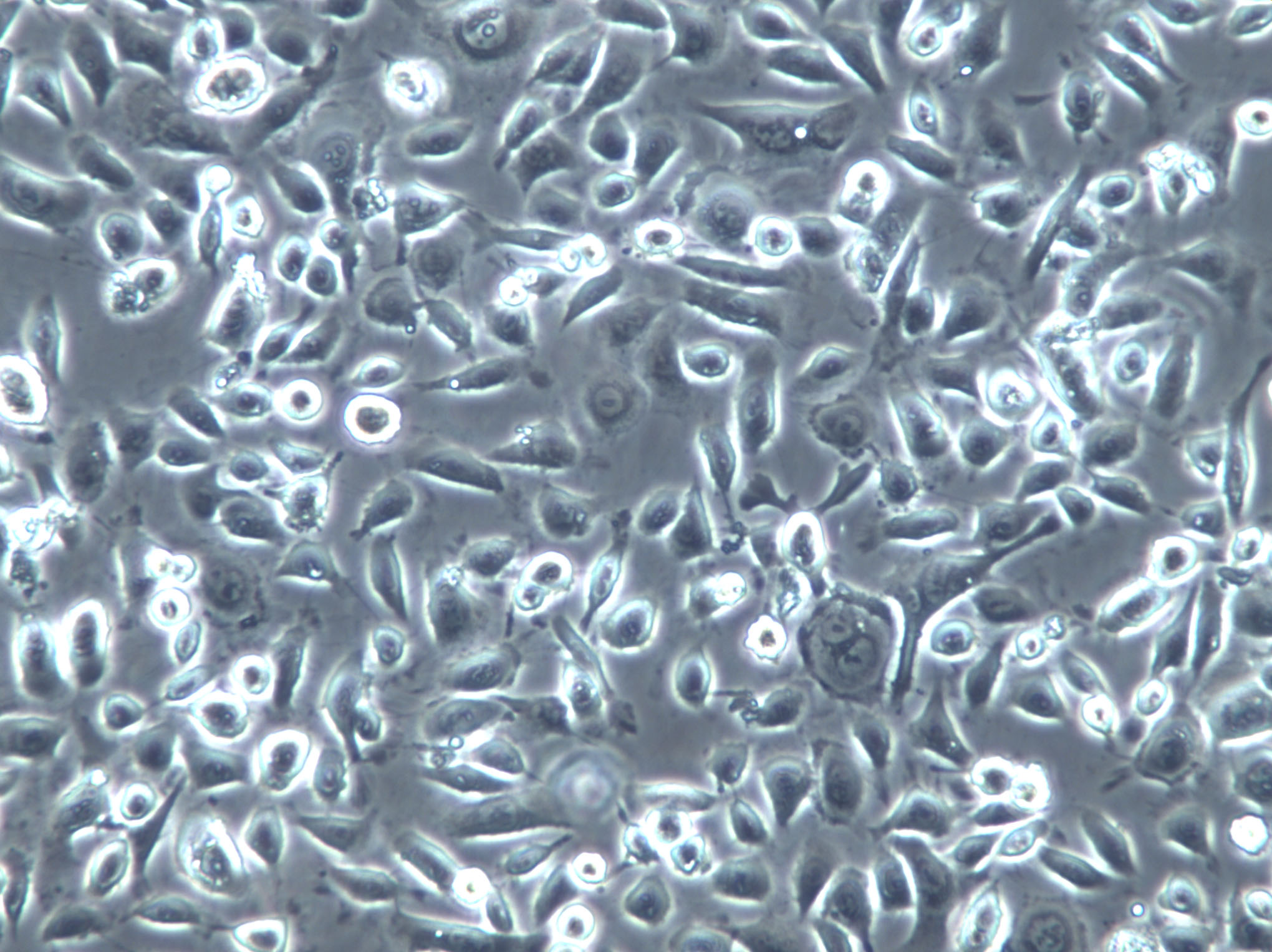 HIT-T15 Cells(贈(zèng)送Str鑒定報(bào)告)|倉(cāng)鼠beta胰島細(xì)胞,HIT-T15 Cells