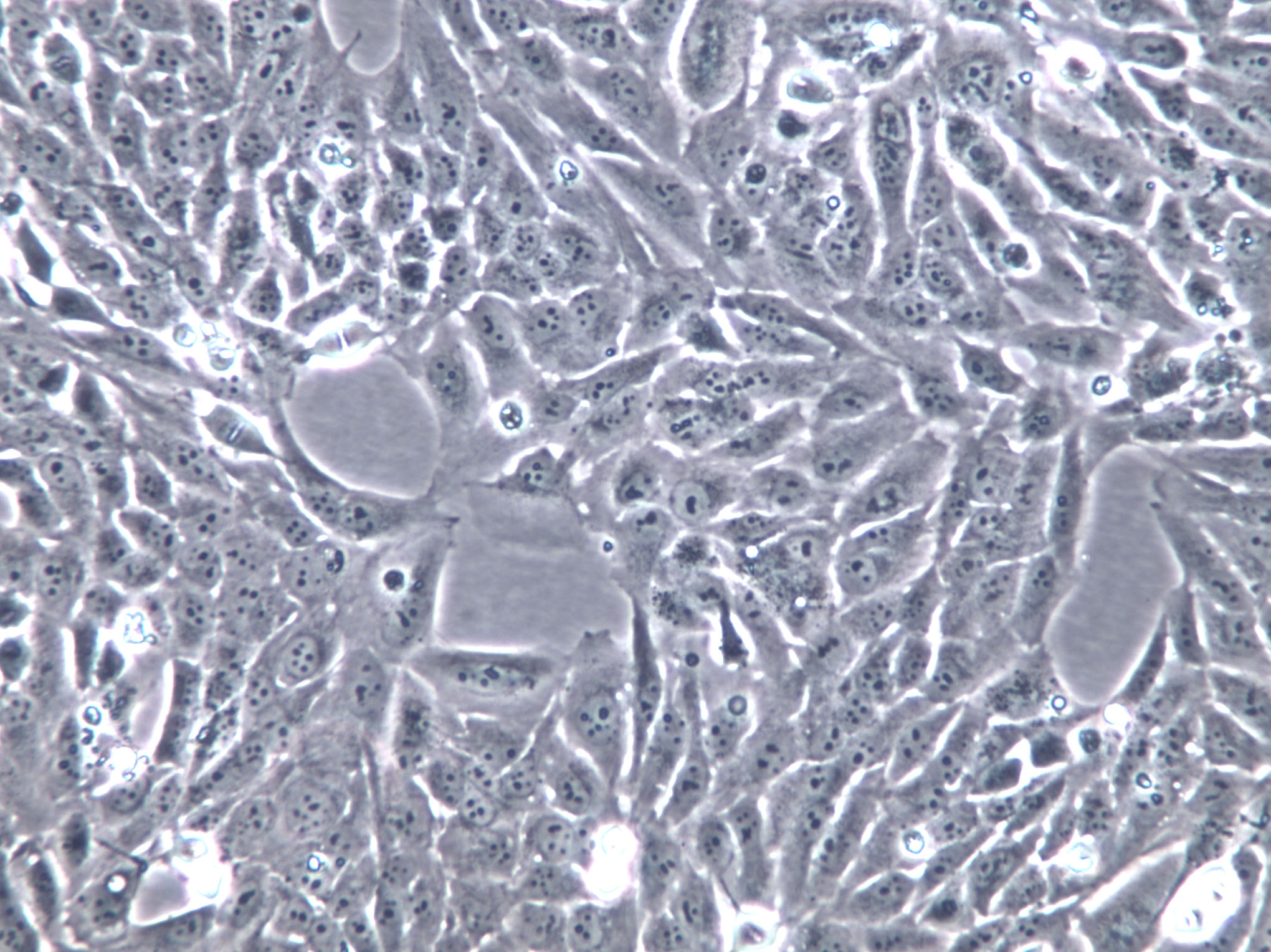 hTERT-HPNE Cells(赠送Str鉴定报告)|人胰腺导管上皮细胞,hTERT-HPNE Cells