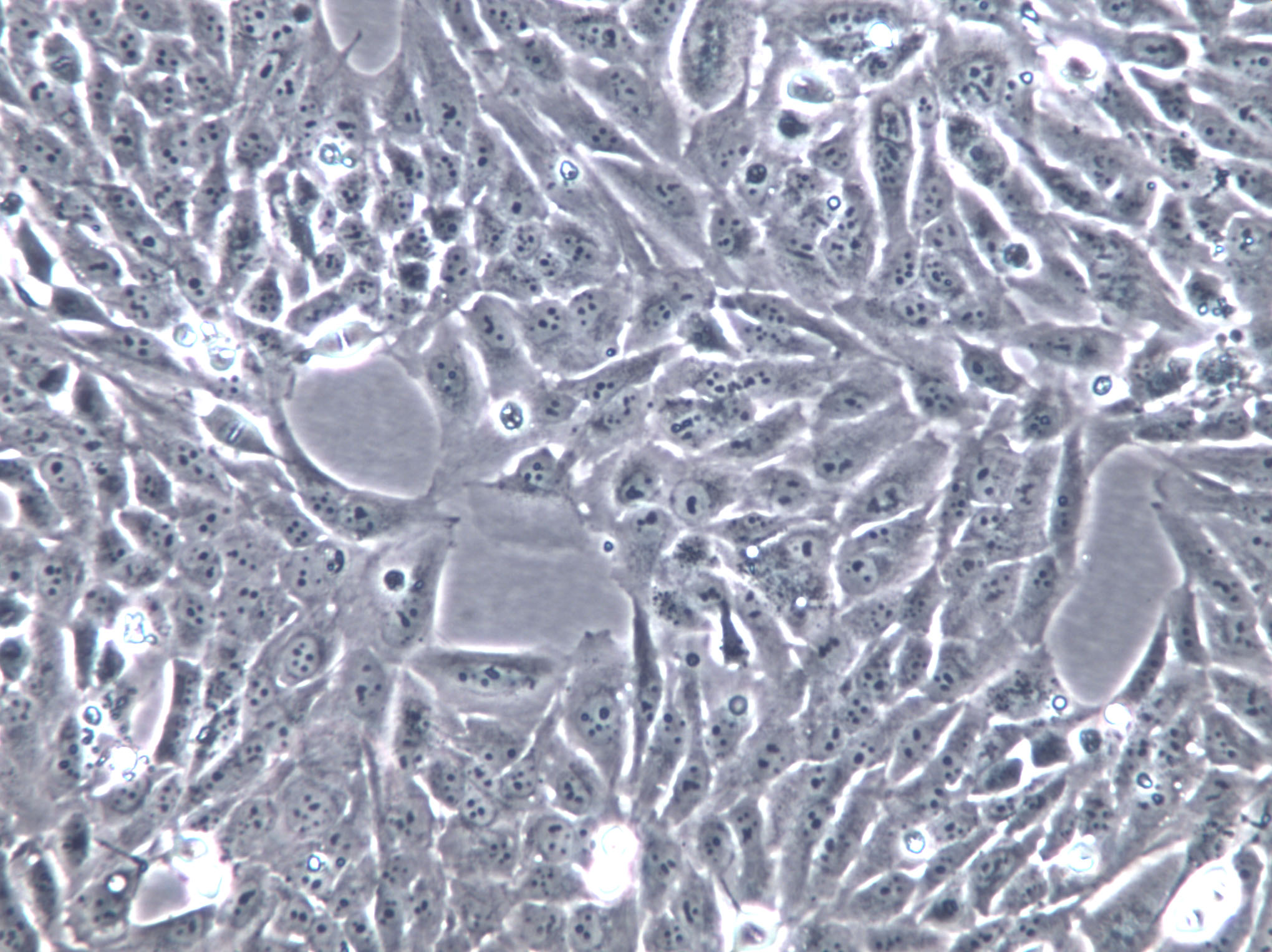 hTERT-HPNE Cells(贈送Str鑒定報(bào)告)|人胰腺導(dǎo)管上皮細(xì)胞,hTERT-HPNE Cells