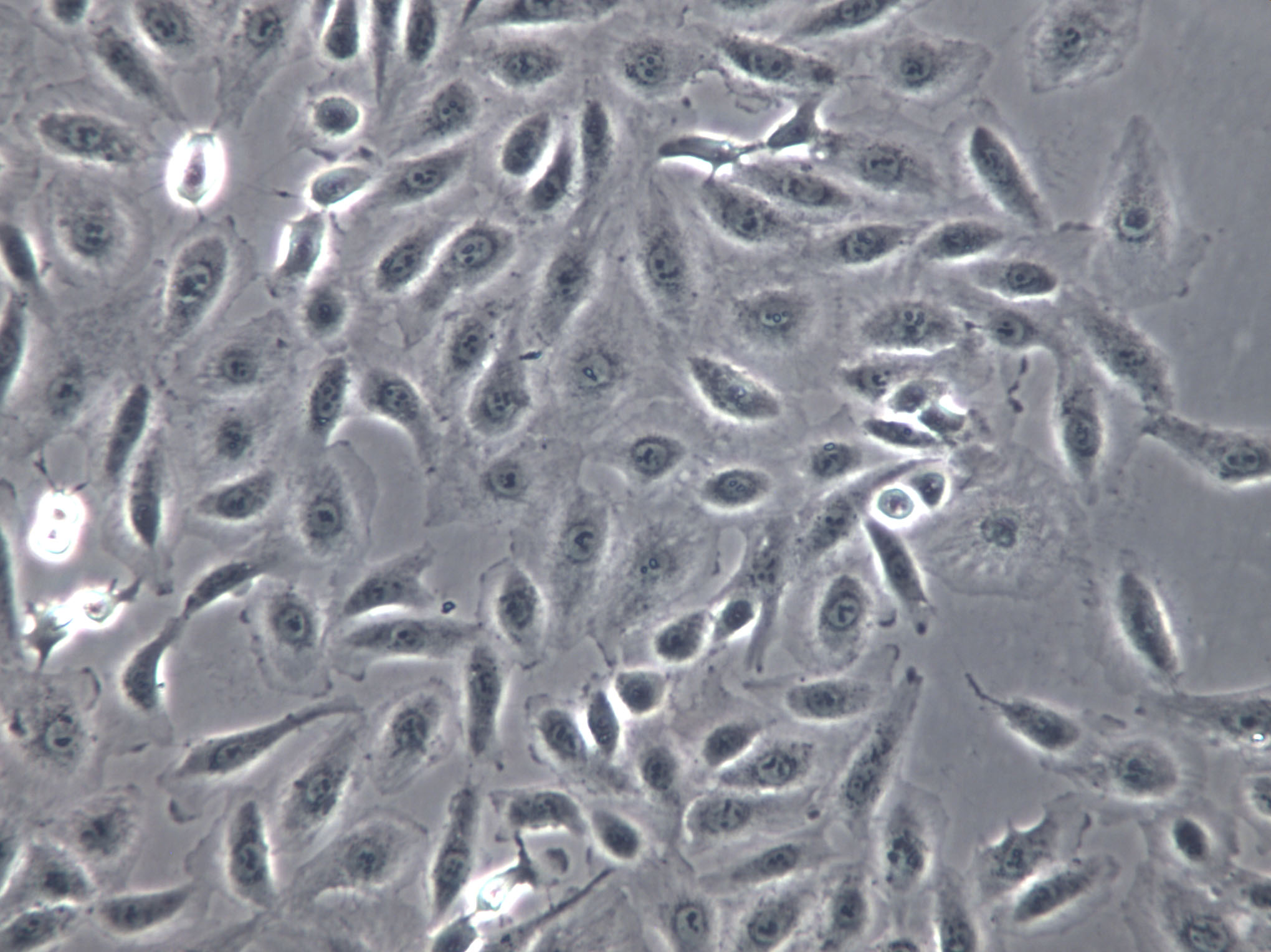 FRO Cells(贈送Str鑒定報告)|人未分化甲狀腺癌細胞,FRO Cells