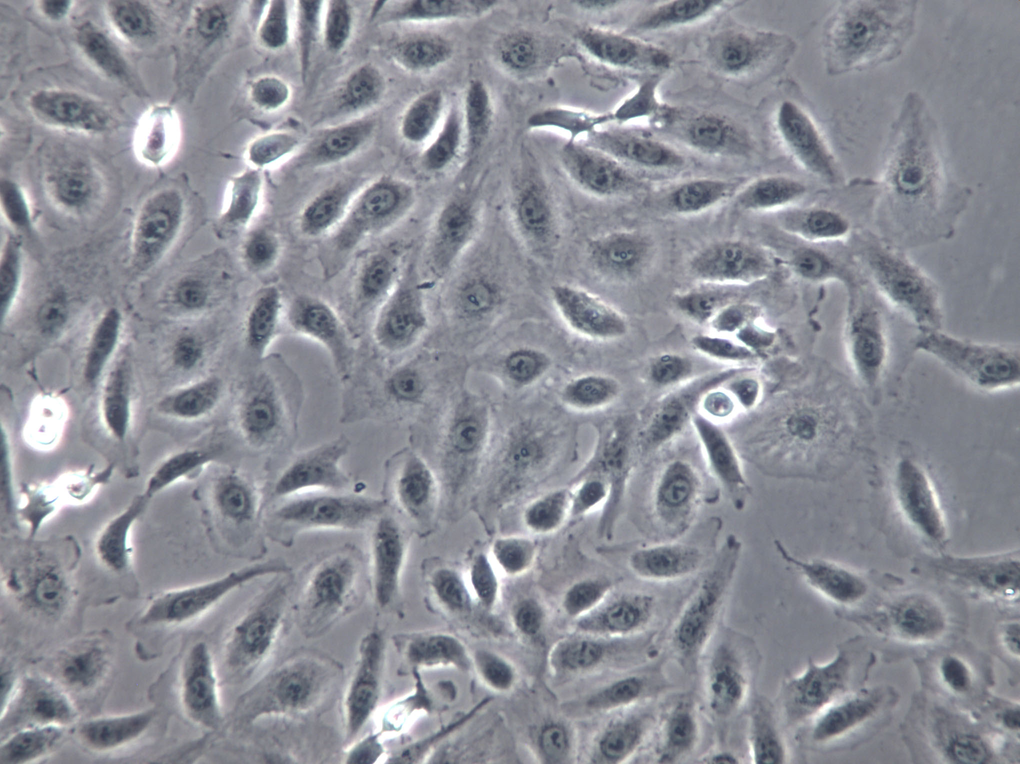 TCam-2 Cells|人睾丸精原细胞瘤克隆细胞,TCam-2 Cells