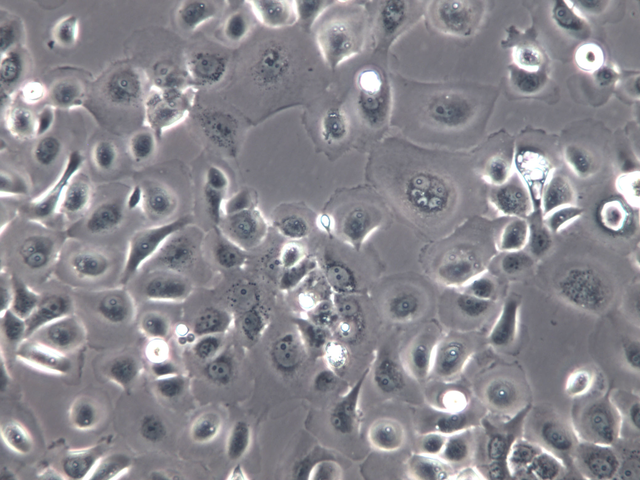 B104 [Rat neuroblastoma] Cells(赠送Str鉴定报告)|大鼠神经母细胞瘤细胞,B104 [Rat neuroblastoma] Cells
