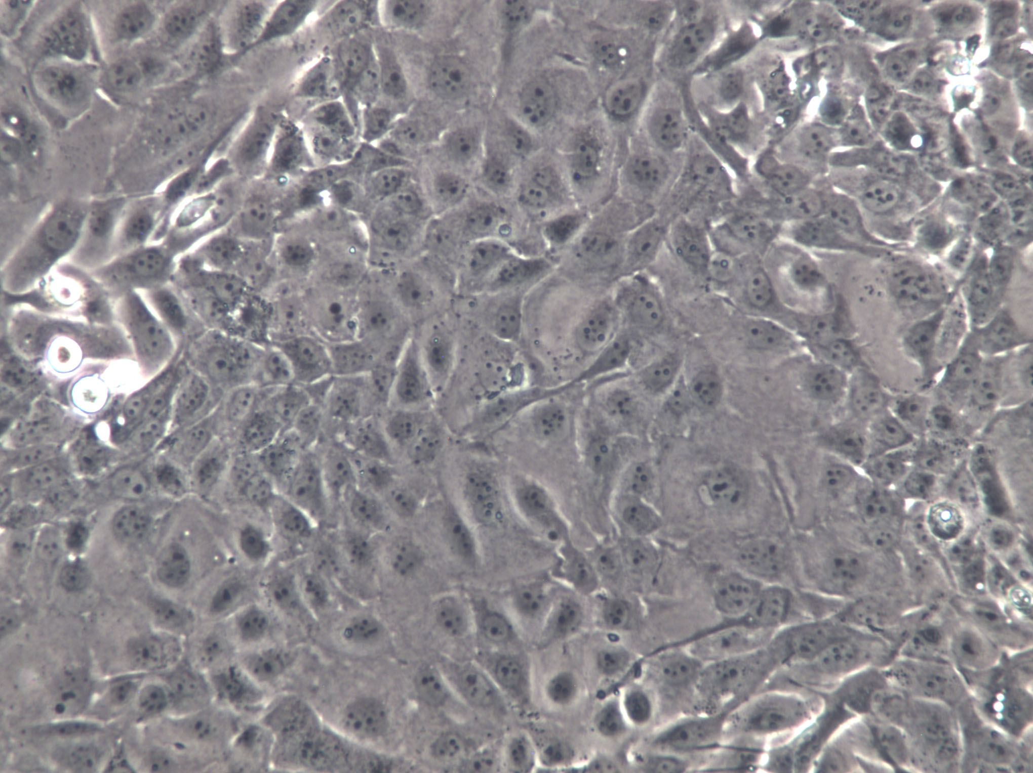 MPC-5 Cells(赠送Str鉴定报告)|小鼠肾足细胞,MPC-5 Cells