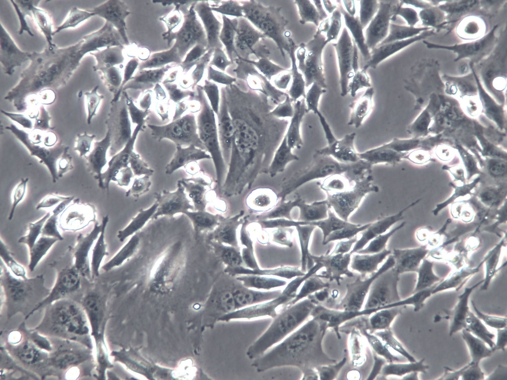 BAEC Cells(赠送Str鉴定报告)|牛主动脉内皮细胞,BAEC Cells