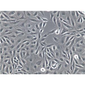 LMH Cells(赠送Str鉴定报告)|鸡肝癌细胞