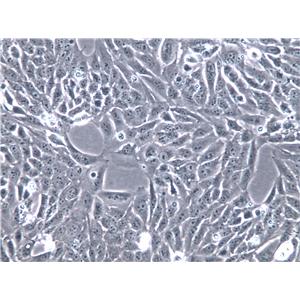 hTERT-HPNE Cells(赠送Str鉴定报告)|人胰腺导管上皮细胞