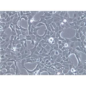 Rh30 Cells(赠送Str鉴定报告)|人横纹肌肉瘤细胞