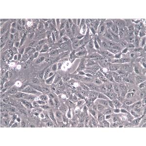 SBC-3 Cells(赠送Str鉴定报告)|人小细胞肺癌细胞