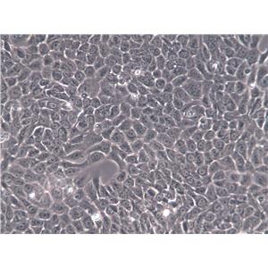 IOSE-29 Cells(赠送Str鉴定报告)|人卵巢上皮细胞