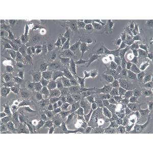 HCCLM6 Cells(赠送Str鉴定报告)|人肝癌细胞,HCCLM6 Cells