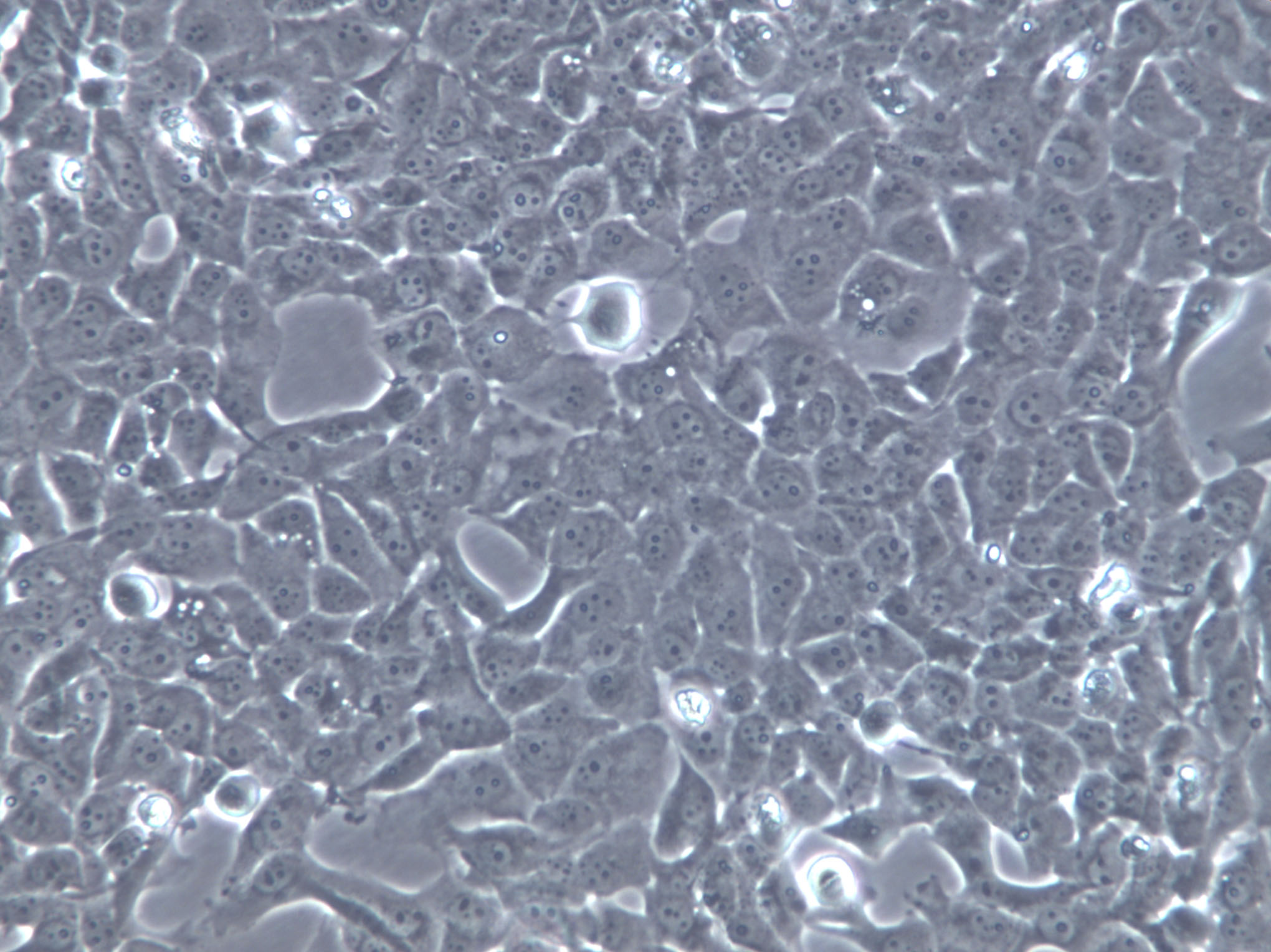 MUTZ-1 Cells(贈(zèng)送Str鑒定報(bào)告)|人骨髓增生異常綜合征細(xì)胞,MUTZ-1 Cells