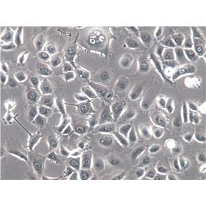 MTEC1 Cells(赠送Str鉴定报告)|小鼠胸腺上皮细胞