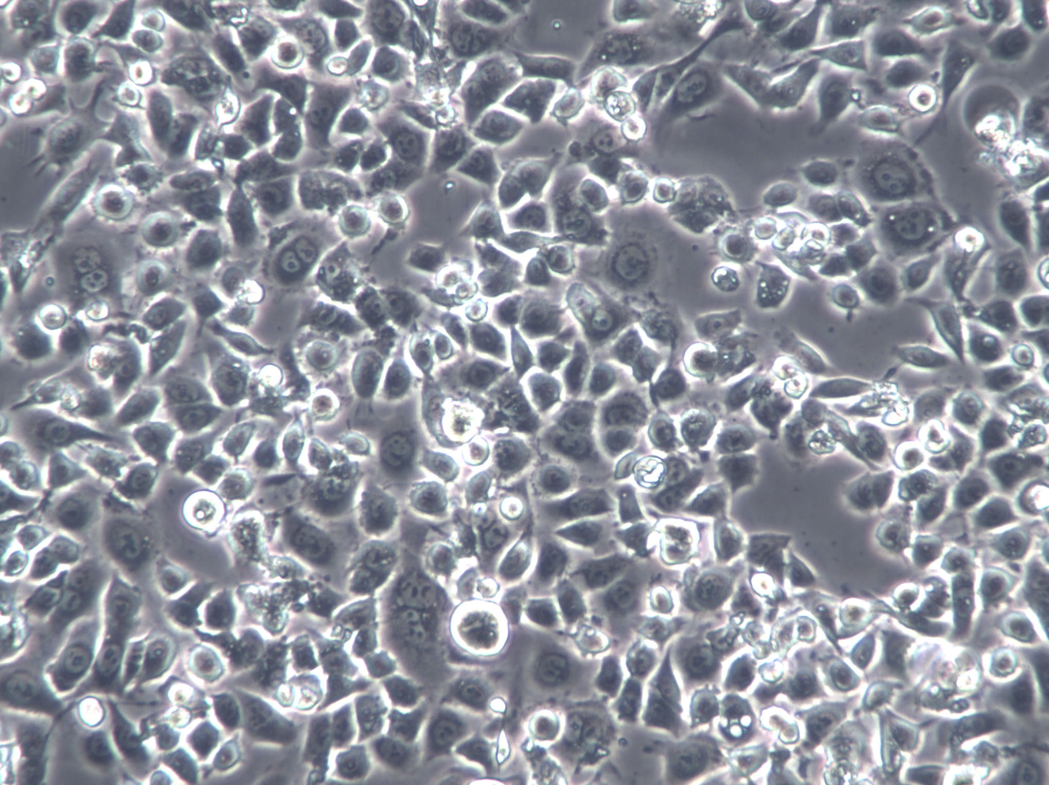 NCI-H295R Cells|人肾上腺皮质腺癌克隆细胞,NCI-H295R Cells