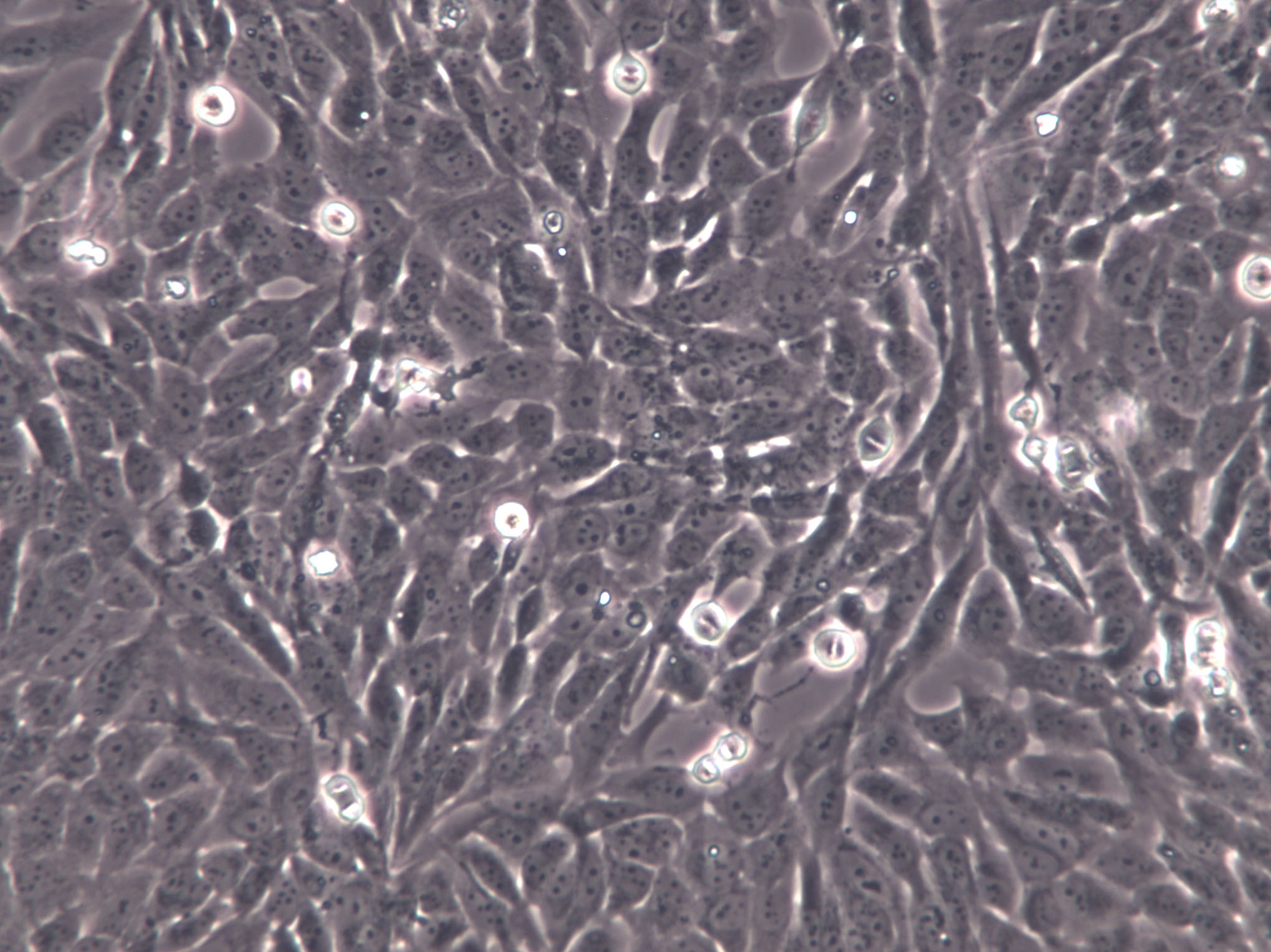 GC-2spd(ts) Cells(贈送Str鑒定報告)|小鼠精母細胞,GC-2spd(ts) Cells