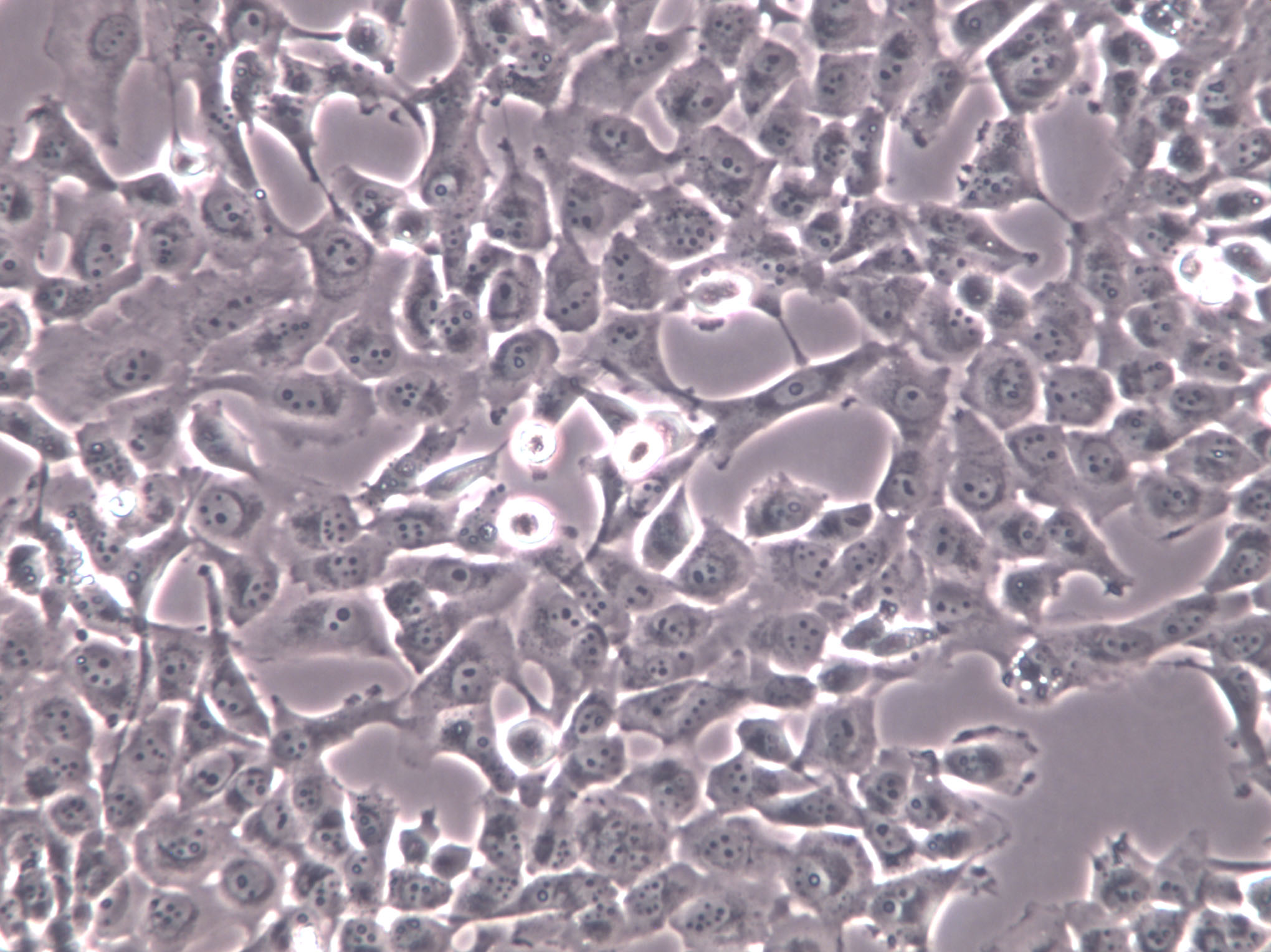 CMT93 Cells(赠送Str鉴定报告)|小鼠结肠癌细胞,CMT93 Cells