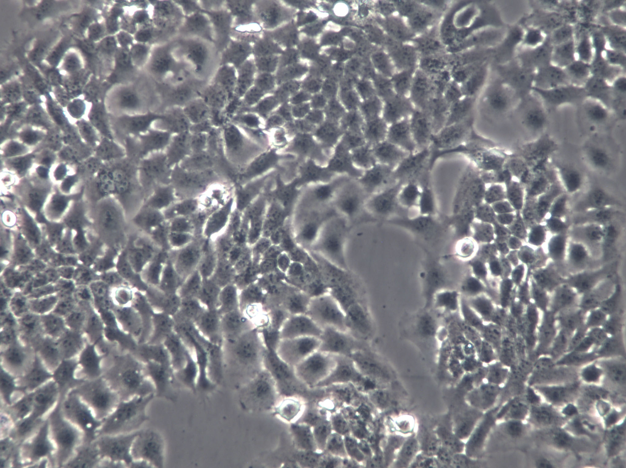 Tb 1 Lu Cells(赠送Str鉴定报告)|蝙蝠肺细胞,Tb 1 Lu Cells
