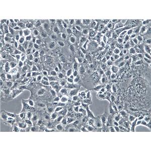 SACC-83 Cells(赠送Str鉴定报告)|涎腺腺样囊性癌细胞