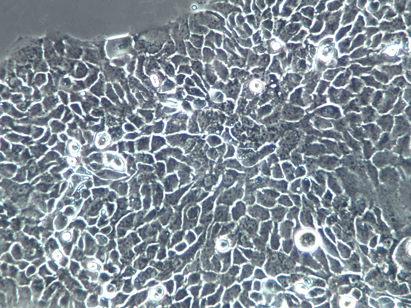 Y1 Cells(赠送Str鉴定报告)|小鼠肾上腺皮质瘤细胞,Y1 Cells