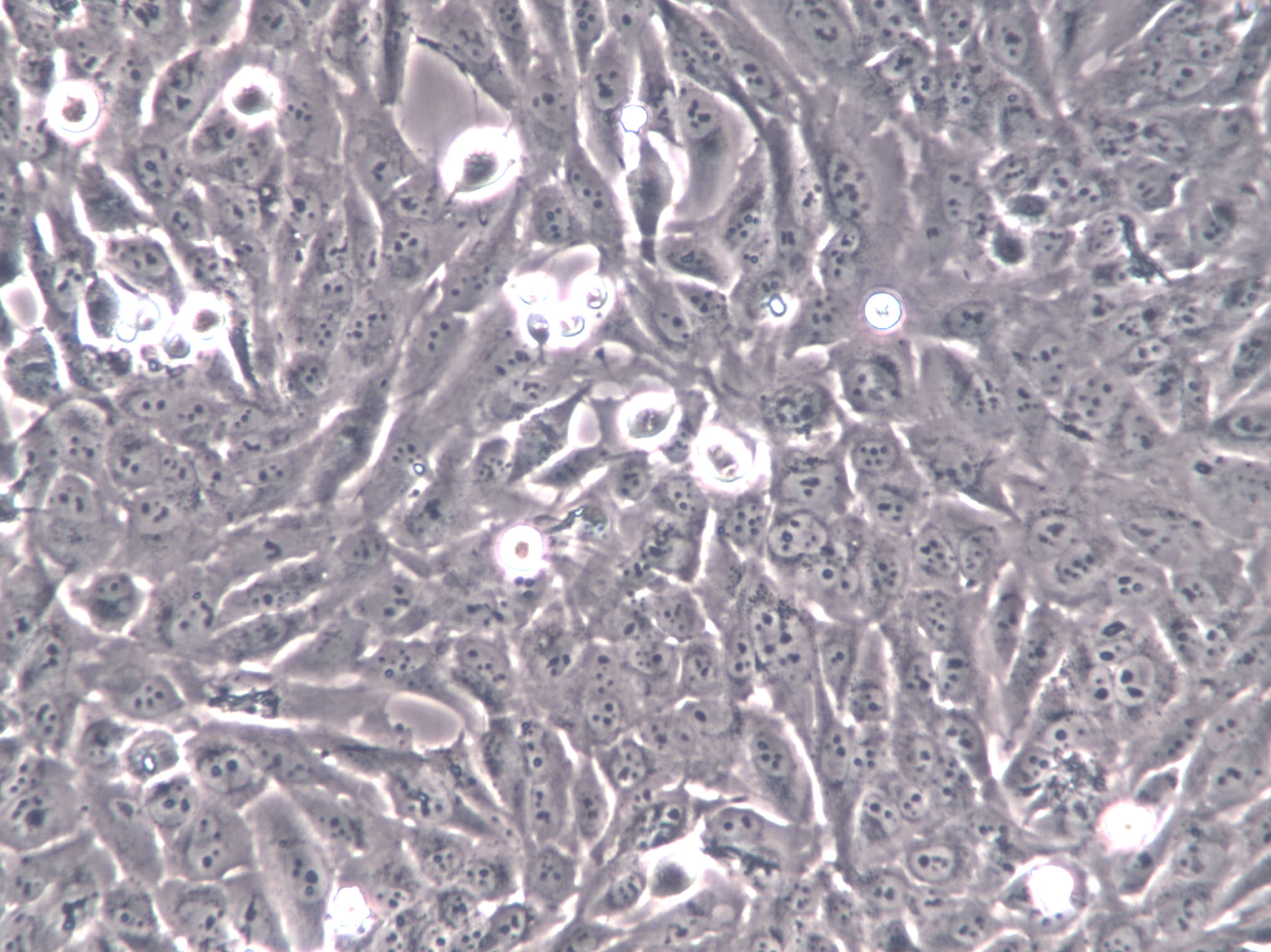 MH-S Cells|小鼠肺泡巨噬克隆细胞,MH-S Cells