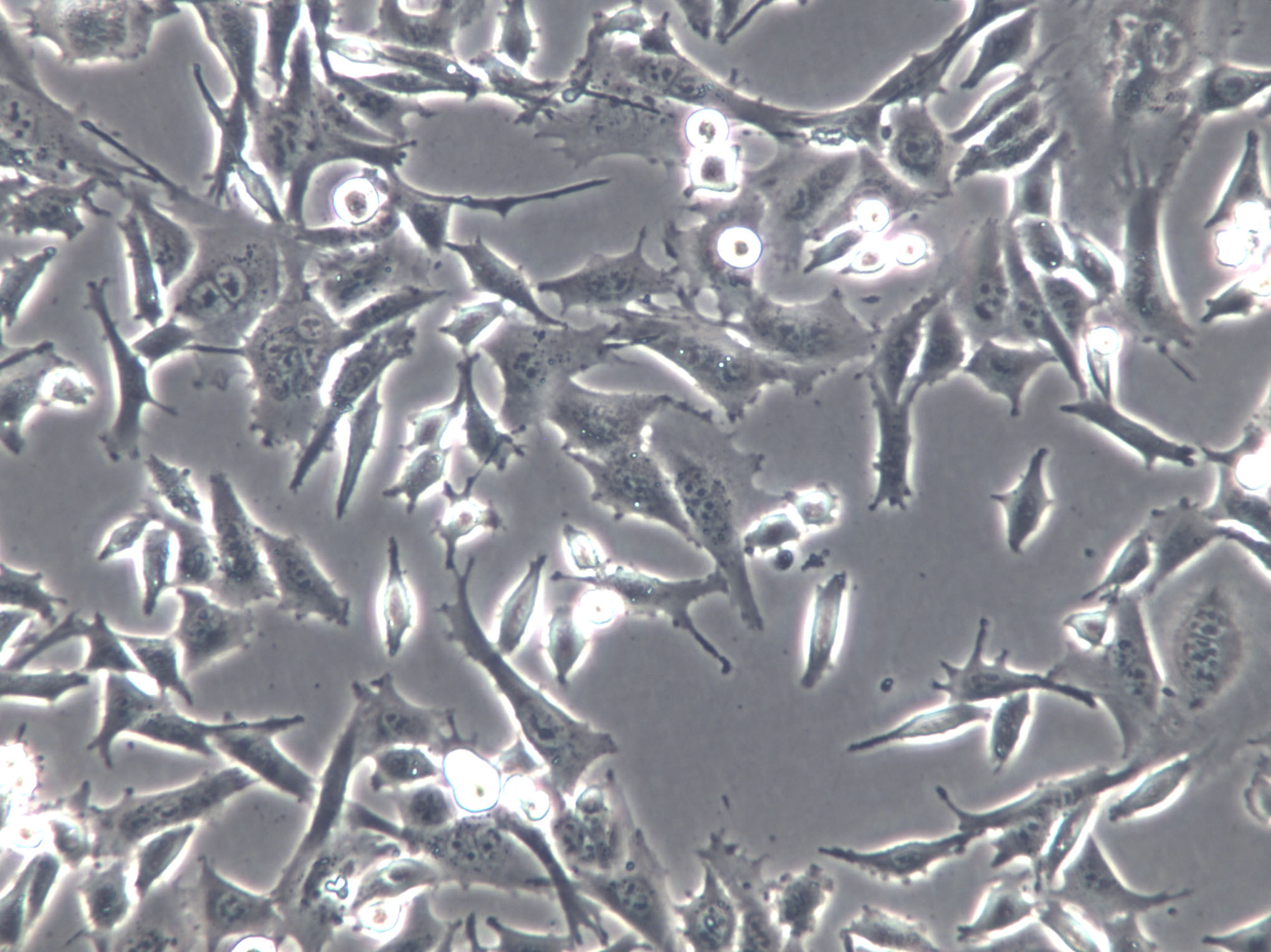 RF/6A Cells(赠送Str鉴定报告)|猴脉络膜-视网膜(内皮)细胞,RF/6A Cells