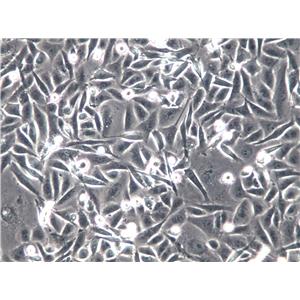 P815 Cells(赠送Str鉴定报告)|小鼠肥大细胞瘤细胞,P815 Cells