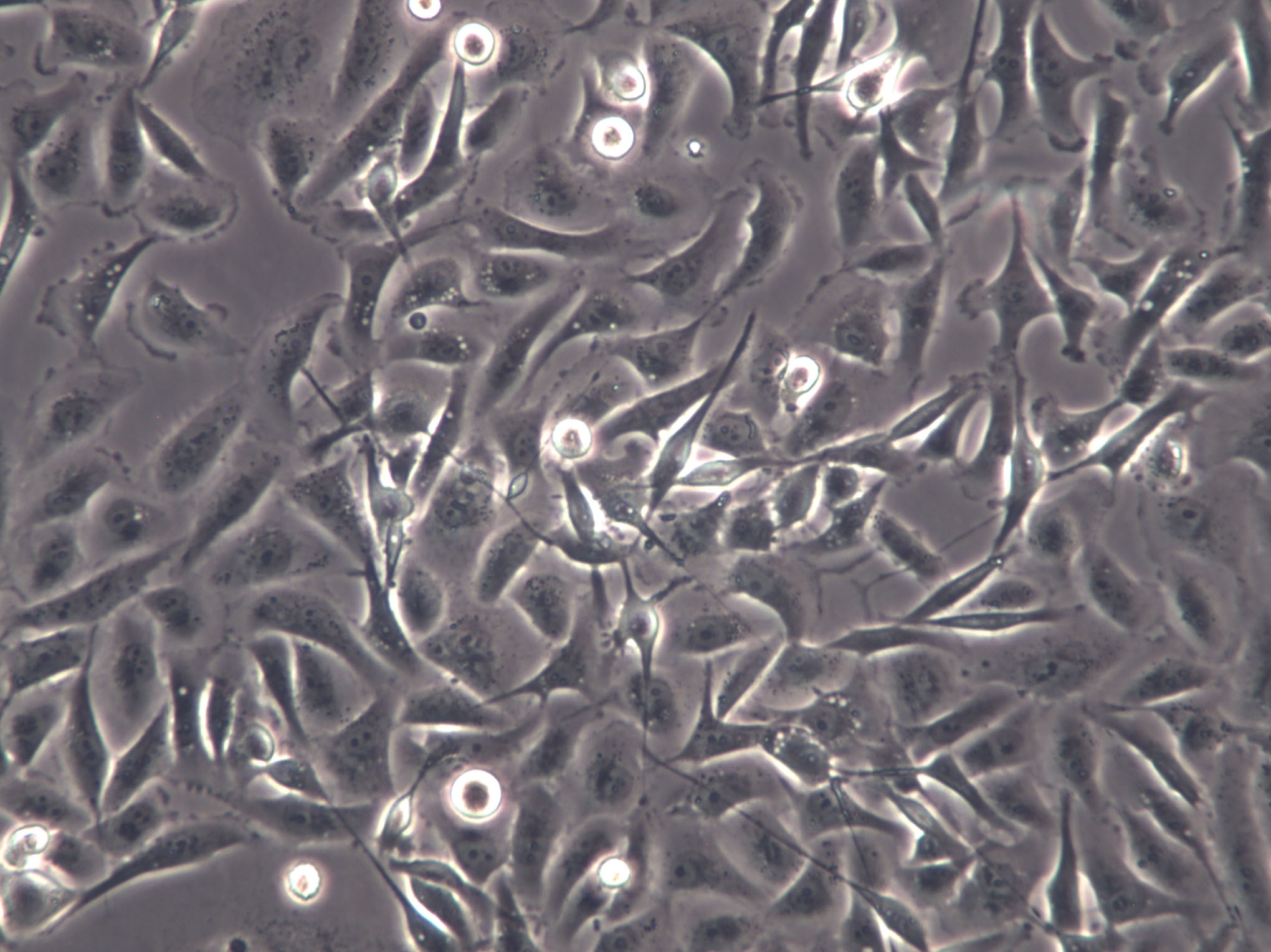 STC-1 Cells(赠送Str鉴定报告)|小鼠小肠内分泌细胞,STC-1 Cells