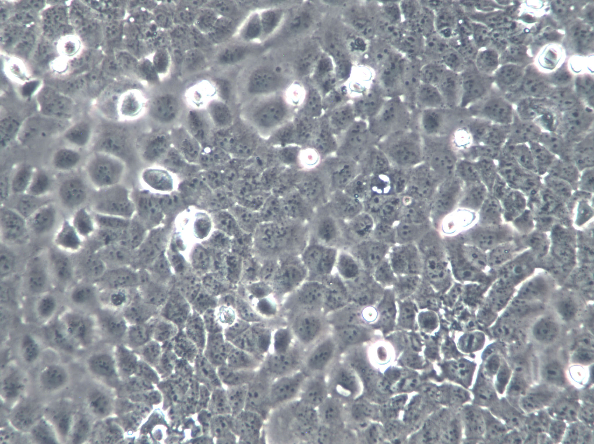 NCTC 1469 Cells(赠送Str鉴定报告)|小鼠正常肝细胞,NCTC 1469 Cells