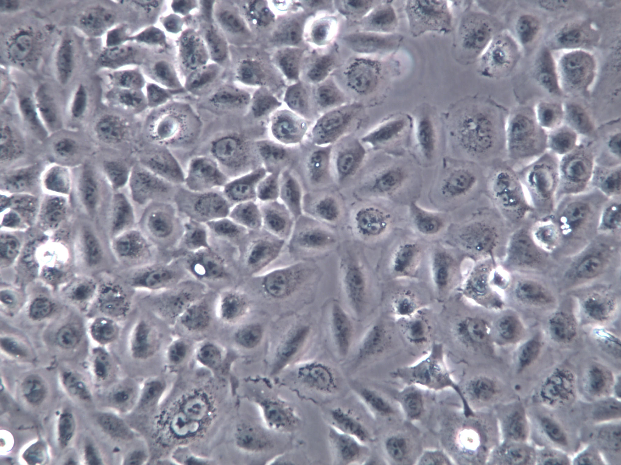 HCCLM6 Cells|人肝癌克隆细胞,HCCLM6 Cells