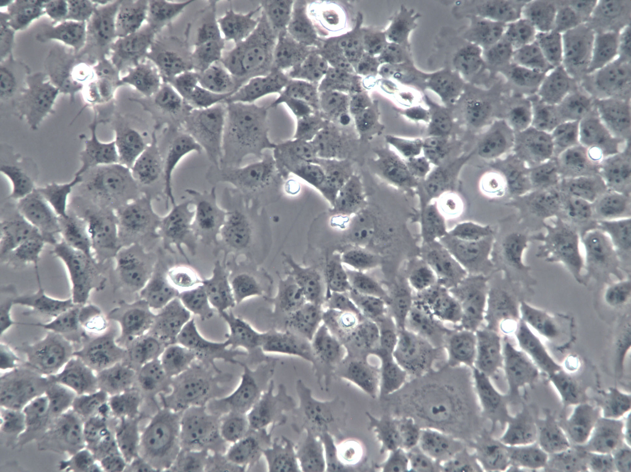 Hca-F Cells|小鼠肝癌克隆细胞,Hca-F Cells