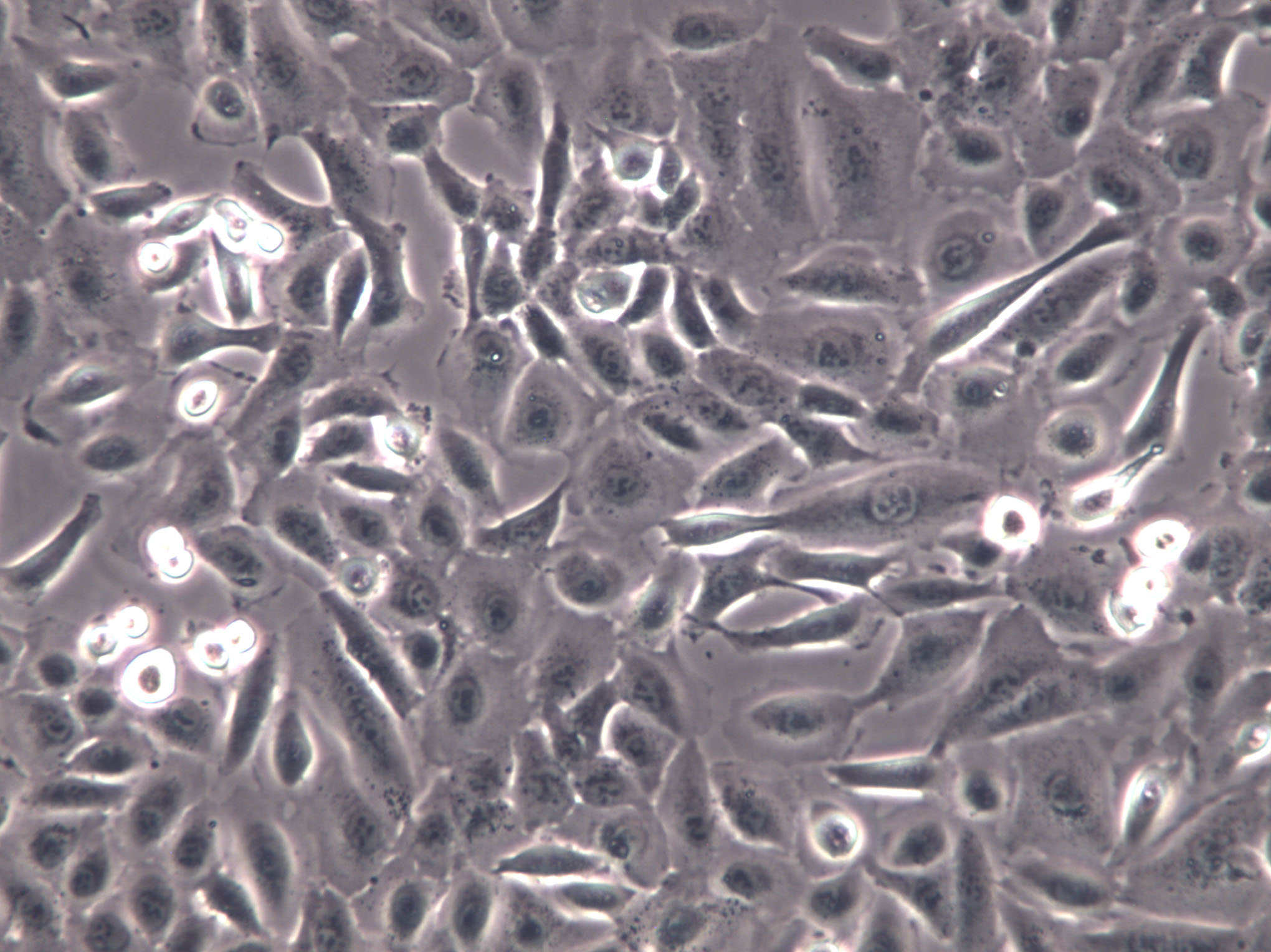 HCC1588 Cells|人肺鳞癌克隆细胞,HCC1588 Cells