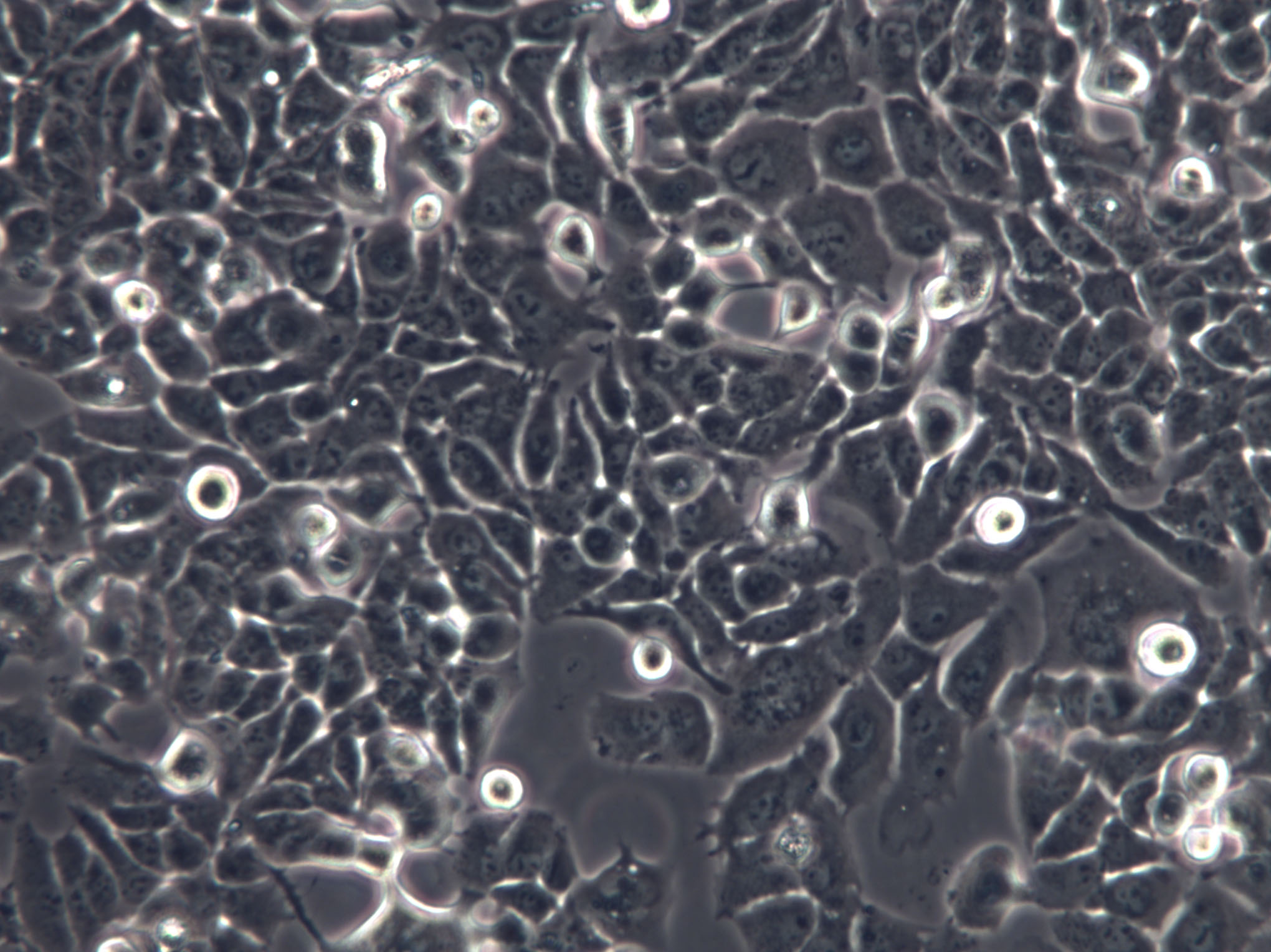 SNU-251 Cells|人卵巢内膜癌克隆细胞,SNU-251 Cells