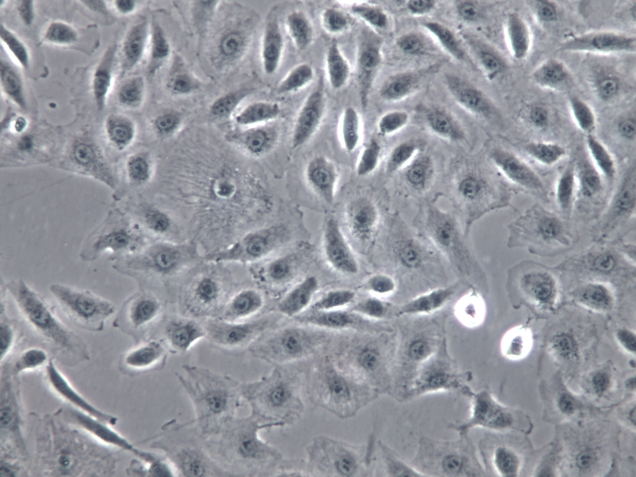 KLN205 Cells|小鼠肺鳞癌克隆细胞,KLN205 Cells