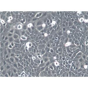 NCTC 1469 Cells(赠送Str鉴定报告)|小鼠正常肝细胞