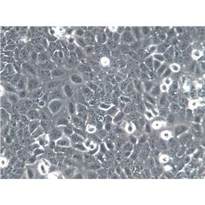 hTERT-HPNE Cells|人胰腺导管上皮克隆细胞