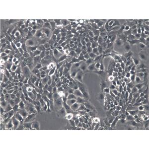 Ect1/E6E7 Cells|人宫颈永生化鳞状克隆细胞